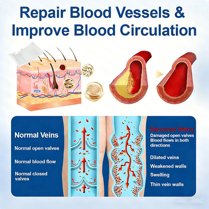𝐏𝐮𝐫𝐞𝐥𝐨𝐫𝐚® 𝐃𝐢𝐨𝐬𝐦𝐢𝐧 & 𝐀𝐞𝐬𝐜𝐢𝐧 𝐕𝐞𝐢𝐧 𝐂𝐨𝐧𝐭𝐨𝐮𝐫 𝐌𝐢𝐜𝐫𝐨𝐧𝐞𝐞𝐝𝐥𝐞 𝐏𝐚𝐭𝐜𝐡 🌿𝟕-𝐃𝐚𝐲 𝐕𝐢𝐬𝐢𝐛𝐥𝐞 𝐑𝐞𝐬𝐮𝐥𝐭𝐬 𝐟𝐨𝐫 𝐕𝐚𝐫𝐢𝐜𝐨𝐬𝐞 𝐕𝐞𝐢𝐧𝐬 - 𝐀𝐝𝐯𝐚𝐧𝐜𝐞𝐝 𝐇𝐞𝐫𝐛𝐚𝐥 𝐁𝐥𝐞𝐧𝐝 𝐓𝐚𝐫𝐠𝐞𝐭𝐬 𝐒𝐩𝐢𝐝𝐞𝐫 𝐕𝐞𝐢𝐧𝐬 & 𝐑𝐞𝐥𝐢𝐞𝐯𝐞𝐬 𝐇𝐞𝐚𝐯𝐲, 𝐓𝐢𝐫𝐞𝐝 𝐋𝐞𝐠𝐬🦵