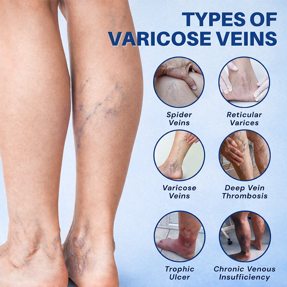 𝐏𝐮𝐫𝐞𝐥𝐨𝐫𝐚® 𝐃𝐢𝐨𝐬𝐦𝐢𝐧 & 𝐀𝐞𝐬𝐜𝐢𝐧 𝐕𝐞𝐢𝐧 𝐂𝐨𝐧𝐭𝐨𝐮𝐫 𝐌𝐢𝐜𝐫𝐨𝐧𝐞𝐞𝐝𝐥𝐞 𝐏𝐚𝐭𝐜𝐡 🌿𝟕-𝐃𝐚𝐲 𝐕𝐢𝐬𝐢𝐛𝐥𝐞 𝐑𝐞𝐬𝐮𝐥𝐭𝐬 𝐟𝐨𝐫 𝐕𝐚𝐫𝐢𝐜𝐨𝐬𝐞 𝐕𝐞𝐢𝐧𝐬 - 𝐀𝐝𝐯𝐚𝐧𝐜𝐞𝐝 𝐇𝐞𝐫𝐛𝐚𝐥 𝐁𝐥𝐞𝐧𝐝 𝐓𝐚𝐫𝐠𝐞𝐭𝐬 𝐒𝐩𝐢𝐝𝐞𝐫 𝐕𝐞𝐢𝐧𝐬 & 𝐑𝐞𝐥𝐢𝐞𝐯𝐞𝐬 𝐇𝐞𝐚𝐯𝐲, 𝐓𝐢𝐫𝐞𝐝 𝐋𝐞𝐠𝐬🦵