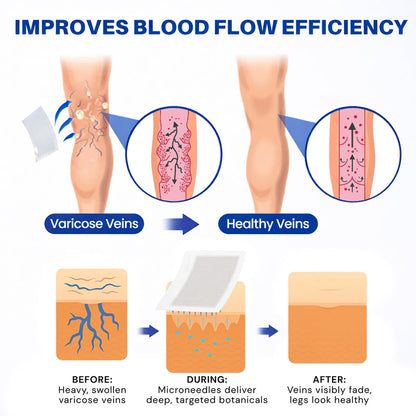 𝐏𝐮𝐫𝐞𝐥𝐨𝐫𝐚® 𝐃𝐢𝐨𝐬𝐦𝐢𝐧 & 𝐀𝐞𝐬𝐜𝐢𝐧 𝐕𝐞𝐢𝐧 𝐂𝐨𝐧𝐭𝐨𝐮𝐫 𝐌𝐢𝐜𝐫𝐨𝐧𝐞𝐞𝐝𝐥𝐞 𝐏𝐚𝐭𝐜𝐡 🌿𝟕-𝐃𝐚𝐲 𝐕𝐢𝐬𝐢𝐛𝐥𝐞 𝐑𝐞𝐬𝐮𝐥𝐭𝐬 𝐟𝐨𝐫 𝐕𝐚𝐫𝐢𝐜𝐨𝐬𝐞 𝐕𝐞𝐢𝐧𝐬 - 𝐀𝐝𝐯𝐚𝐧𝐜𝐞𝐝 𝐇𝐞𝐫𝐛𝐚𝐥 𝐁𝐥𝐞𝐧𝐝 𝐓𝐚𝐫𝐠𝐞𝐭𝐬 𝐒𝐩𝐢𝐝𝐞𝐫 𝐕𝐞𝐢𝐧𝐬 & 𝐑𝐞𝐥𝐢𝐞𝐯𝐞𝐬 𝐇𝐞𝐚𝐯𝐲, 𝐓𝐢𝐫𝐞𝐝 𝐋𝐞𝐠𝐬🦵